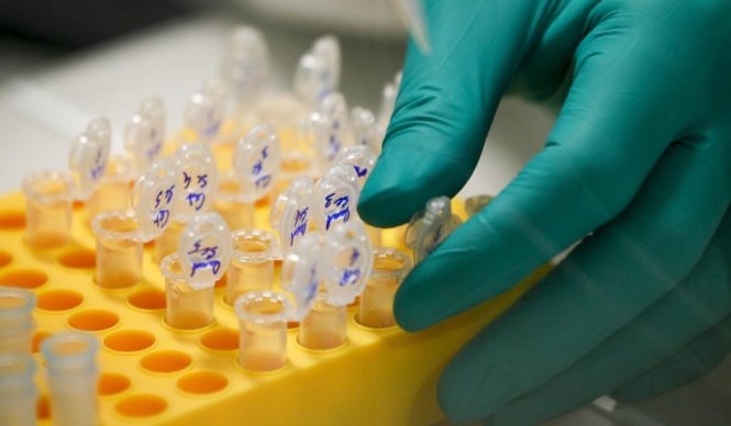 Loại virut ATCV-1 làm suy giảm khả năng não bộ được phát hiện một cách tình cờ trong phòng thí nghiệm - Ảnh: Reuters