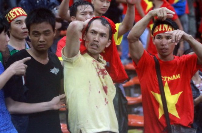 Hình ảnh CĐV Việt Nam bị hành hung rướm máu trên sân Shah Alam tối ngày 7-12 - Ảnh: Nguyên Khôi