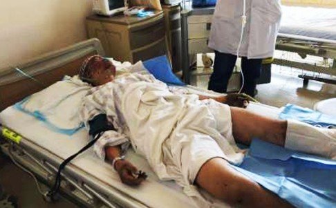 Anh Zhou Ti đang điều trị ở bệnh viện - Ảnh: South China Morning Post