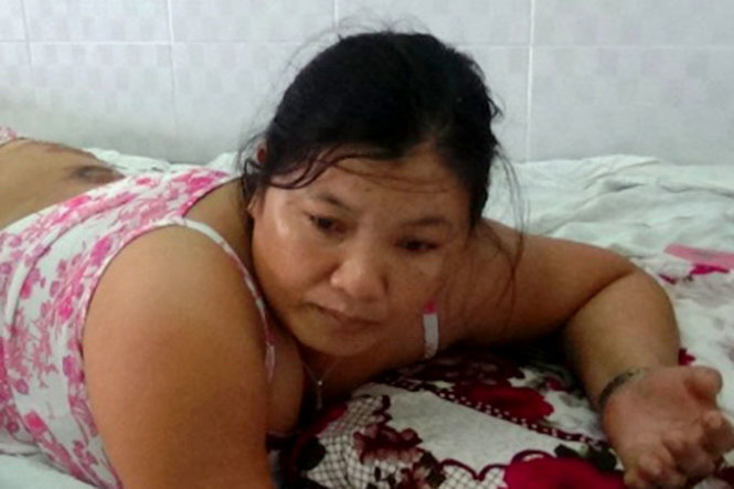 Bà mẹ đốt con - Trương Thị Vy đang điều trị phỏng tại Bệnh viện Đa khoa Bắc Bình Thuận Ảnh: THIỆN TRÍ