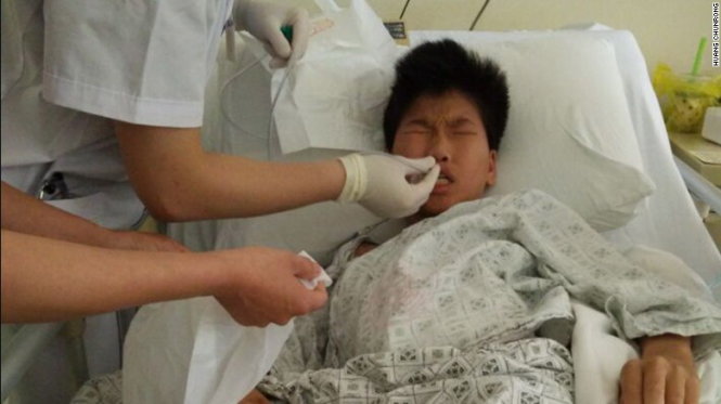 Cậu bé Huang bị bắt nạt và hành hung phải điều trị tại bệnh viện - Ảnh: CNN