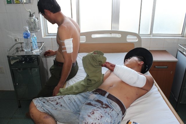 Nhân viên bảo vệ rừng bị chém bị thương chiều 11-12. Ảnh: Yến Thanh