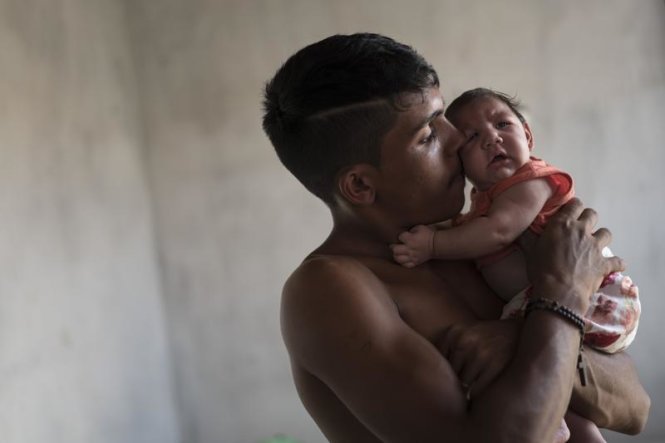 Kể từ tháng 9 năm ngoái, Brazil đã ghi nhận 3.700 trường hợp trẻ sơ sinh mắc chứng đầu nhỏ được cho vì nhiễm virút Zika - Ảnh: Hindustantimes
