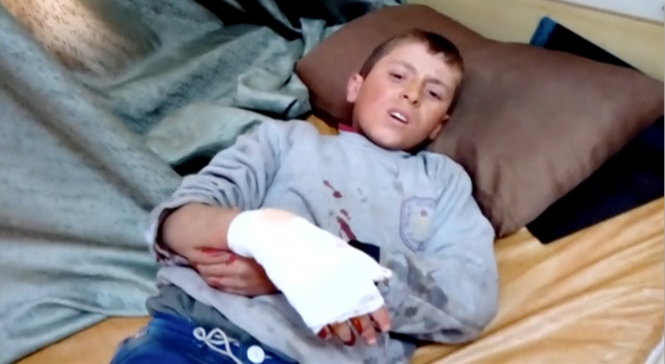 Một cậu bé Syria bị thương sau vụ bắn tên lửa vào bệnh viện ở Azaz - Ảnh: Reuters
