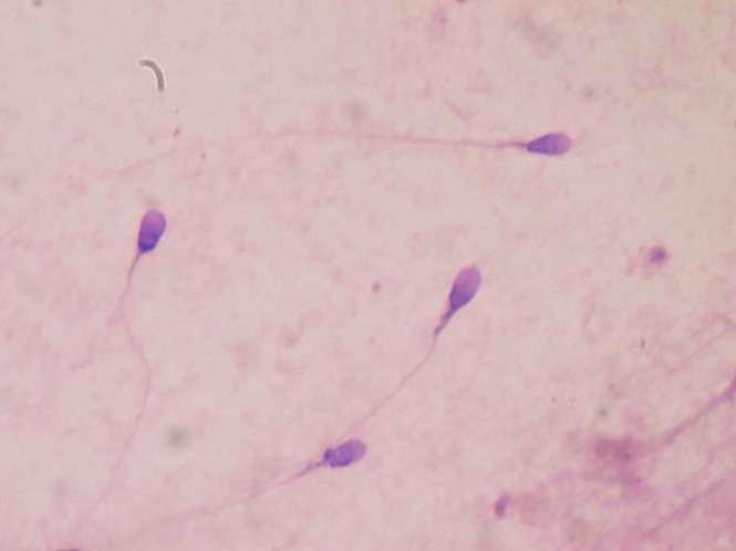 Các nhà khoa học Tây Ban Nha vừa công bố đã tạo ra tinh trùng đầu tiên từ tế bào da người (ảnh minh họa) - Ảnh: Popsci