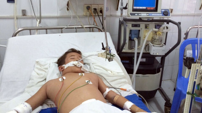 Bé Duy lúc bệnh nặng đang thở máy áp lực cao - Ảnh: Bệnh viện cung cấp