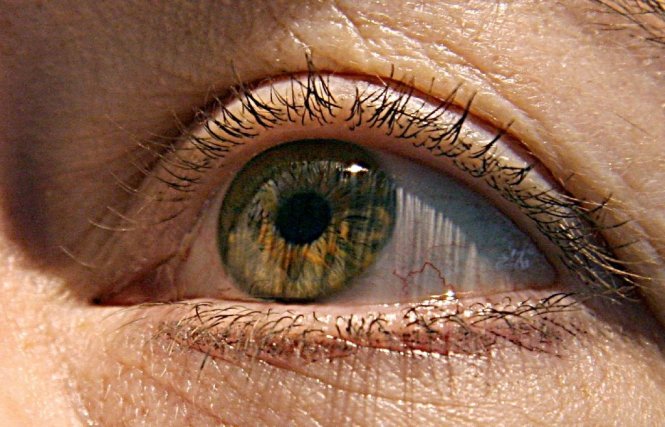 Virút Zika có thể sống trong mắt của người nhiễm bệnh - Ảnh: AFP