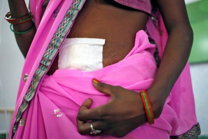 Phụ nữ Ấn Độ đối mặt nhiều rủi ro, bao gồm cả cái chết khi triệt sản tại các trung tâm y tế nước này - Ảnh: Reuters