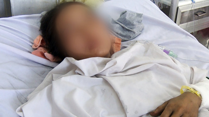 Bệnh nhân bị phỏng đang được điều trị - Ảnh: Bệnh viện Chợ Rẫy cung cấp