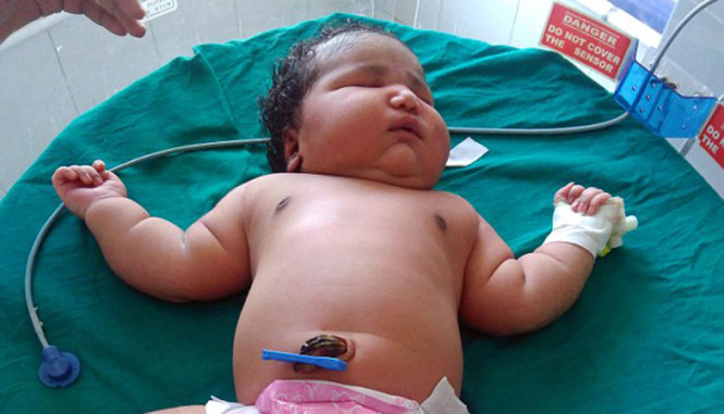 Bé gái sơ sinh nặng nhất thế giới - Ảnh: Daily Mail