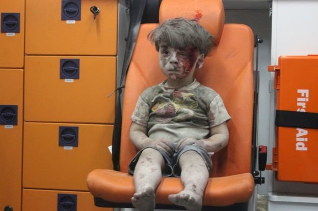 Bức ảnh Orman bê bết máu và bụi trong xe cứu thương đã khiến thế giới xúc động - Ảnh: AFP
