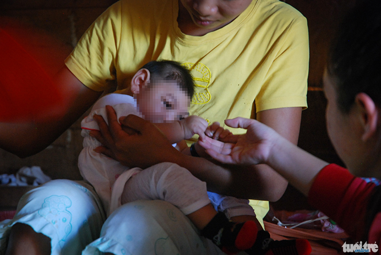 Cháu bé con của chị H'Bươm (xã Cư Pơng, huyện Krông Búk, Đắk Lắk) - ca dị tật đầu nhỏ đầu tiên tại Việt Nam nghi do vi rút Zika