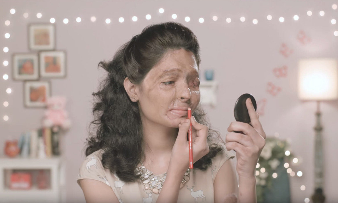 Reshma Bano Quereshi đương đầu với khuôn mặt bị axit tàn phá - Ảnh: The pool