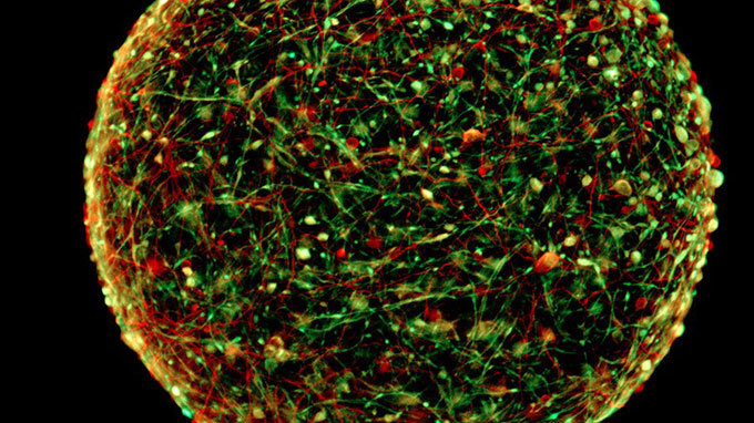 Mô hình não thu nhỏ - Ảnh: ĐH Johns Hopkins