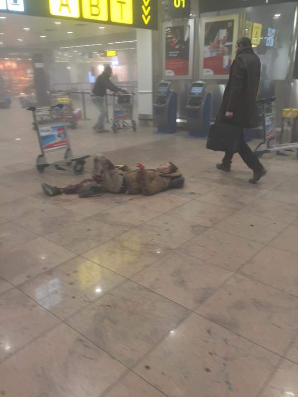 Một nạn nhân trên sàn sân bay sau vụ nổ. Ảnh: Giorgi Tabagari/Twitter