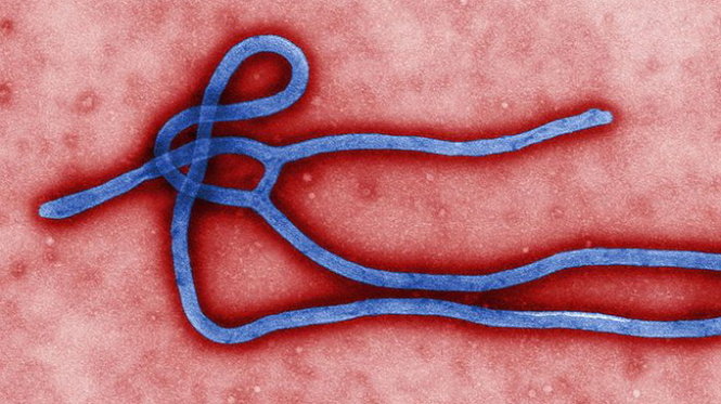 Các nhà khoa học cho biết virút Ebola đang biến thể nhanh chóng ở người - Ảnh: ABC Science