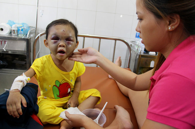 Bé Đỗ Thị Kim Ngân đang được chăm sóc tại bệnh viện - Ảnh: Bá Sơn