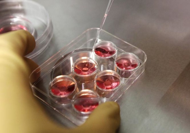 Nhân viên y tế thực hiện trích xuất trứng tại 1 phòng thí nghiệm ở Đài Loan. Ảnh: Reuters