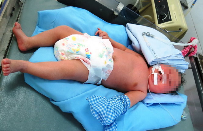 Cháu bé sơ sinh được Bệnh viện Nhi Quảng Nam điều trị - Ảnh: D.H.