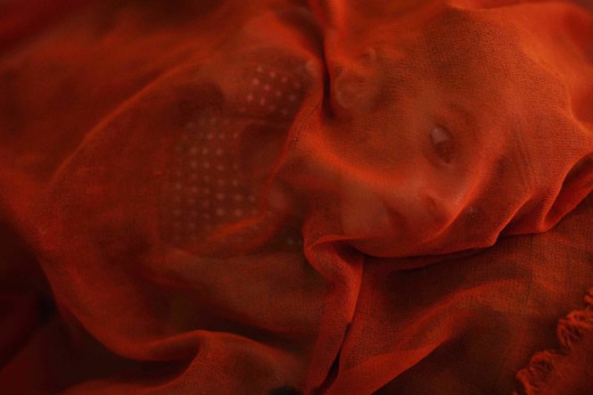 Bức ảnh “bé trai Afghanistan suy dinh dưỡng che khăn màu cam” - Ảnh: Andrew Quilty