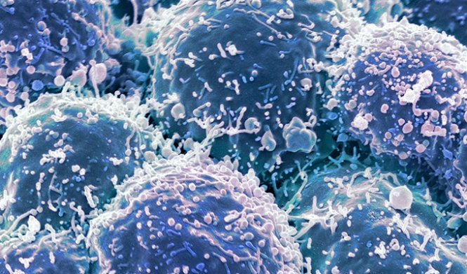 Sử dụng virus biến đổi gene mở ra hướng điều trị ung thư hứa hẹn trong tương lai - Ảnh: Independent