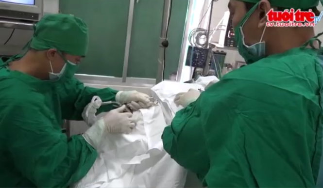 Các bác sĩ đang phẫu thuật gắp con đỉa sống ra khỏi thanh quản bệnh nhân
