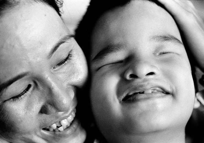 Tấm hình chị Thúy và bé Kiều, đứa con bị chất độc da cam đăng trên trang nhất báo Tuổi Trẻ ngày 14-9 và tràn ngập trong đêm trắng “Góp tay xoa dịu nỗi đau da cam” tại TP.HCM, tháng 9-2004 -  Ảnh: Đoàn Đức Minh