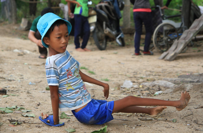 Dù di chuyển khó khăn, Nay Khoen vẫn hồn nhiên vui chơi cùng bạn bè trong buôn làng - Ảnh: Thái Bá Dũng