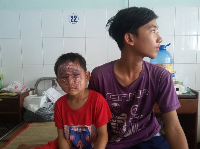 Bé Nguyễn Hoàng Huy đang được điều trị tại Bệnh viện Đa khoa tỉnh Tiền Giang - Ảnh: H.THƯƠNG