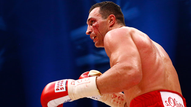 Gương mặt chảy máu của Klitschko ở hiệp 5 - Ảnh: Reuters