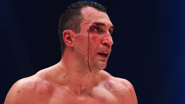 Klitschko bị tét mí mắt phải - Ảnh: Sky Sports