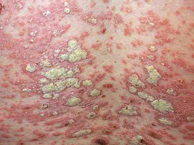 bphdiOIN.jpg