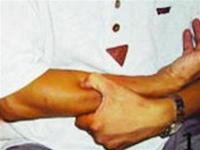 yniA2HxI.jpg