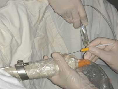 bUcp45nE.jpg