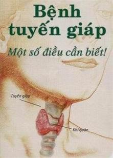 S9fdPXuZ.jpg