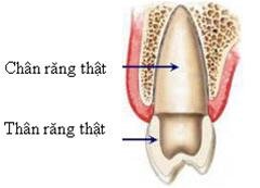 ImBP68yR.jpg