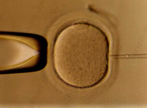 Rn79XiqK.jpg