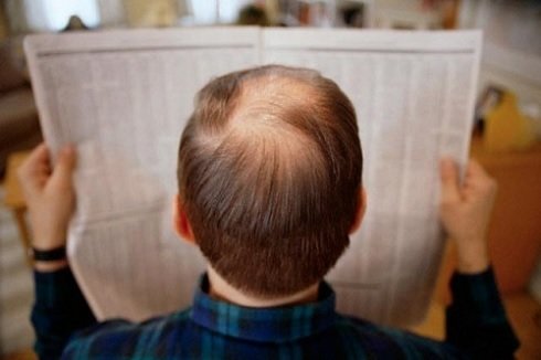 Rụng tóc là một vấn đề được nhiều khách hàng quan tâm. Hãy đến ngay với các chuyên gia tóc để họ có thể tư vấn cho bạn những giải pháp tốt nhất để ngăn ngừa và khắc phục tình trạng rụng tóc hiệu quả nhất nào!