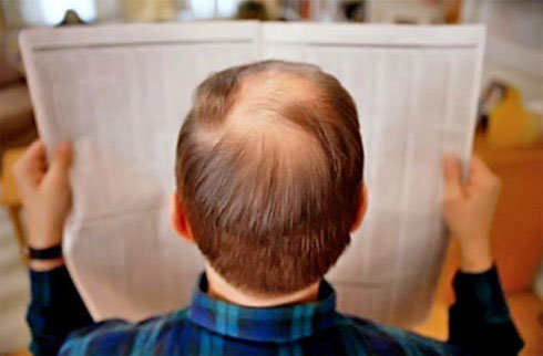 Nguyên nhân gây rụng tóc ở nam có thể bạn chưa biết  Doppelherz