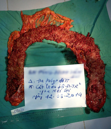 mlO4OMQ4.jpg