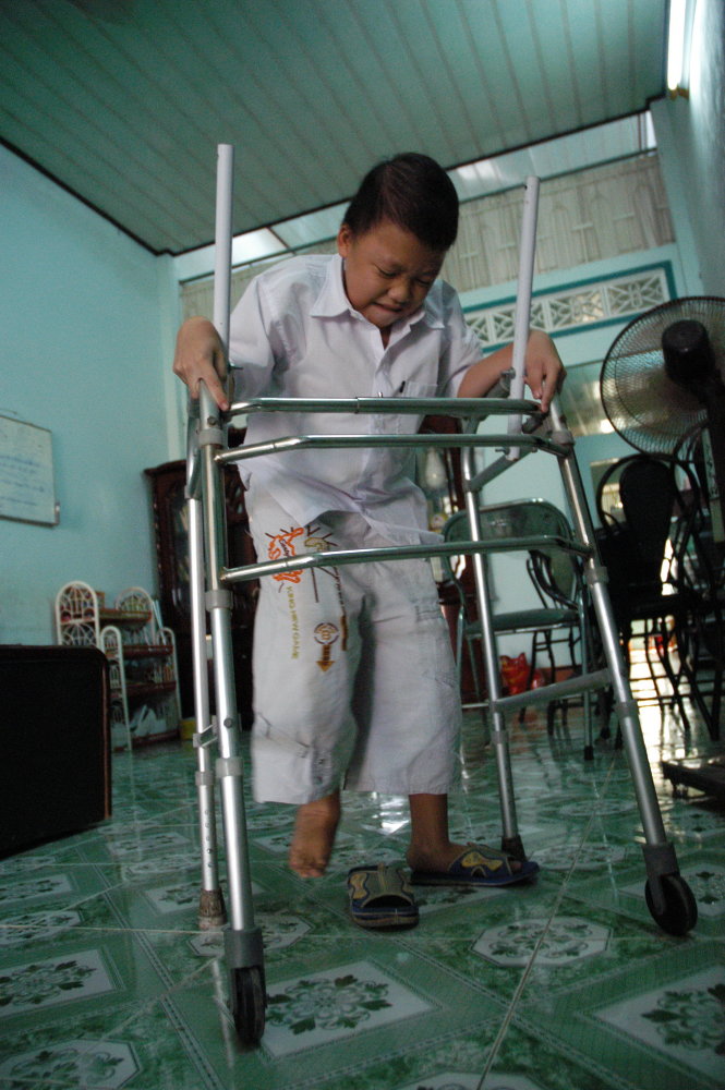 Đỗ Minh Hội tập đi (ảnh chụp năm 2006) - Ảnh: T.Đ.