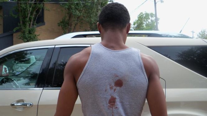 Lưng ông Miller dính máu do Taser gây ra Ảnh: Marie Herndon