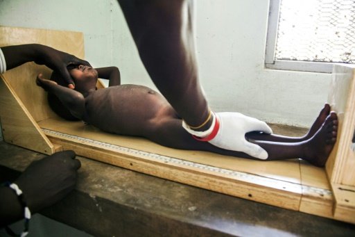 Y tá kiểm tra sức khỏe trẻ suy dinh dưỡng ở Juba, Nam Sudan ngày 9-2 - Ảnh: AFP