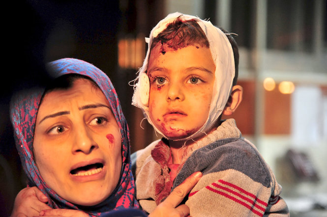 Em bé người Syria bị thương do đánh bom khủng bố ở Damascus được đưa đến bệnh viện chữa trị hôm 21-2 - Ảnh: Reuters