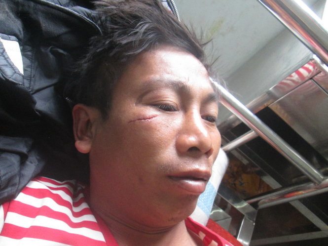 Ông Lai bị đánh đang điều trị tại bệnh viện.