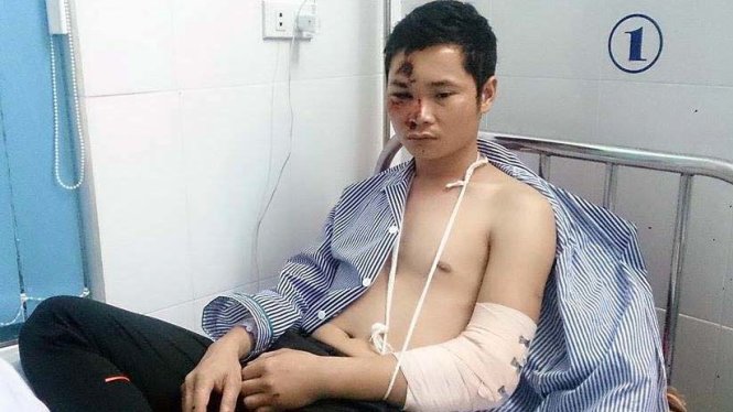 Ông Đặng Thành Chung vẫn đang phải nằm theo dõi tại bệnh viện - Ảnh: Thủy Lệ