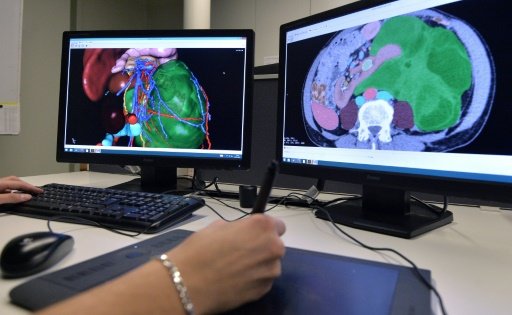 Nhân viên sử dụng phần mềm Visible Patient - Ảnh: AFP