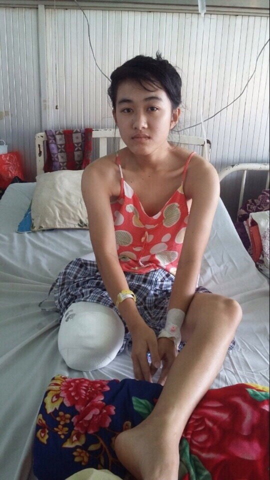 Hình ảnh em Hà Vi sau khi đã cắt bỏ chân phải tại Bệnh viện Chợ Rẫy (TP.HCM)   - Ảnh gia đình cung cấp