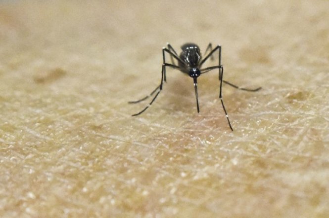 Zika gây ra dị tật bẩm sinh ở các bào thai đang phát triển Ảnh: AFP