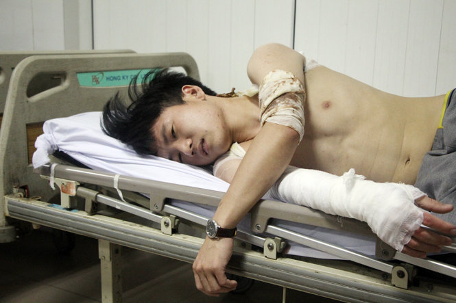 Anh Phạm Thành Nhân, 22 tuổi, công nhân bị thương trong vụ nổ - Ảnh: Doãn Hòa